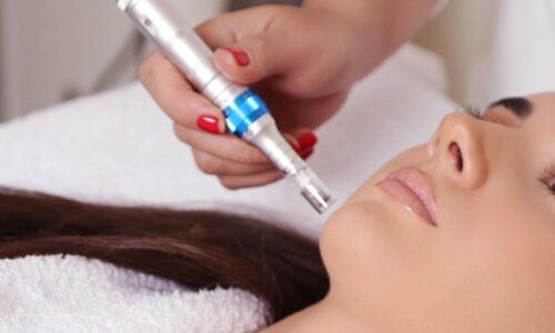 Microneedlin dhe Plazmapen